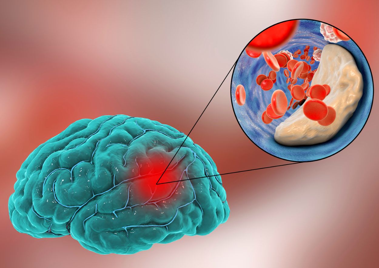 Cannabinoids and Neurological Disorders 2